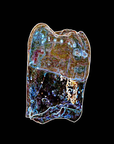 Teeth as Art