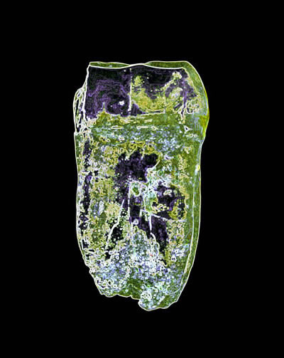 Teeth as Art